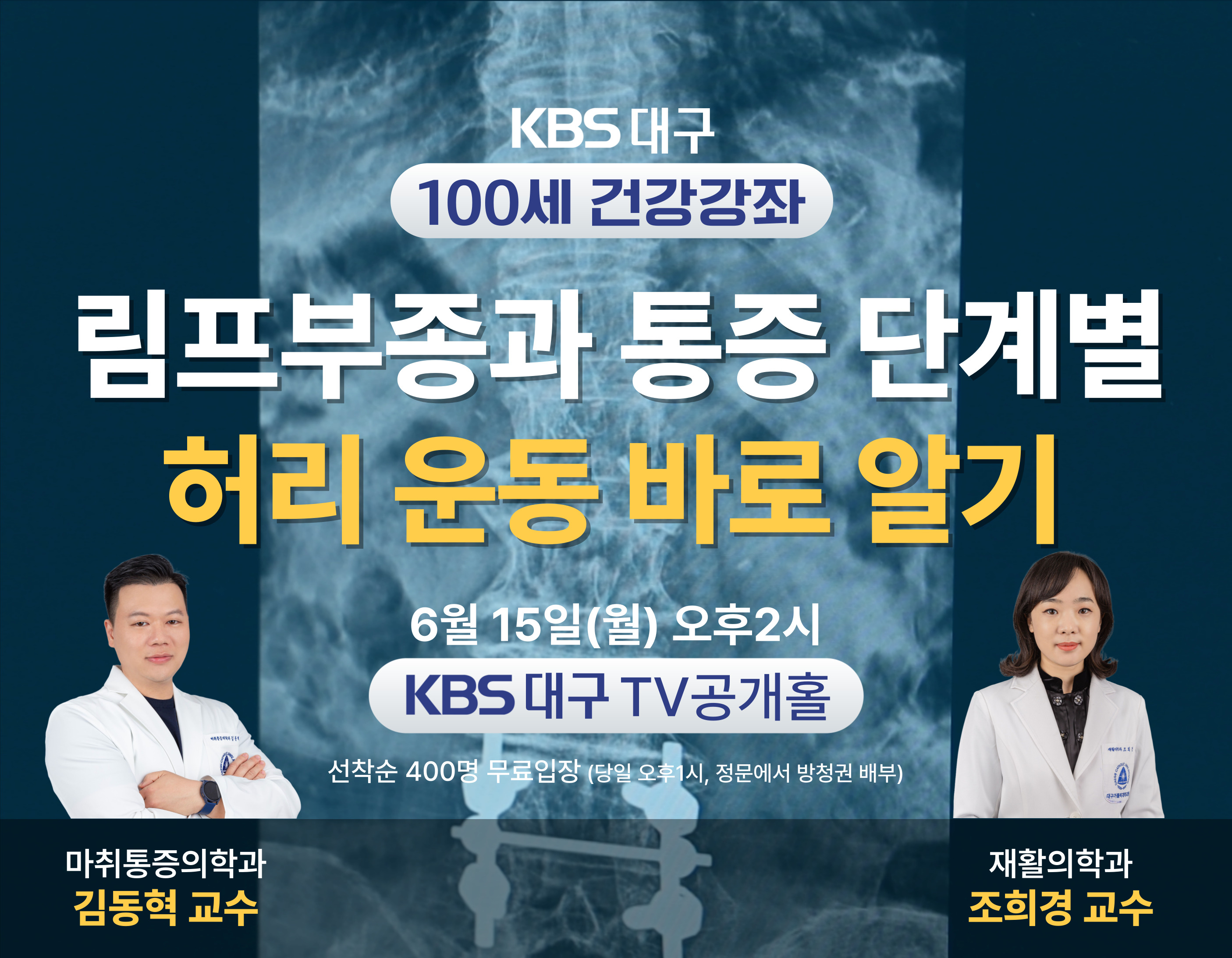 KBS대구 100세 건강강좌 '림프부종과 통증 단계별 허리 운동 바로 알기' 이미지